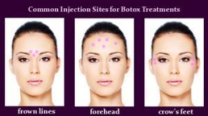 botox estetika skin
